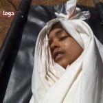 الطفل أمجد أمين الشيخ – دوما – 6 4 2015
