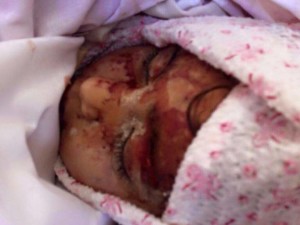 الطفلة شمس ضحية بلدة صيدا