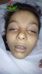 الطفلة ضحي يونس