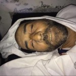 ضحية قنص