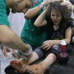طفلة جريحة بقصف النظام السوري على عين ترما بريف دمشق 2 8 2017