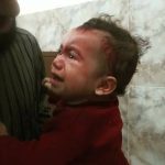 طفل جريح بقصف النظام على تلبيسة بريف حمص 16 10 2017