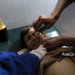 طفل جريح في بلدة حمورية بالغوطة الشرقية بقصف النظام السوري 12 1 2018