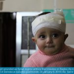 طفلة جريحة بقصف النظام السوري على سقبا بالفوطة الشرقية 8 1 2018